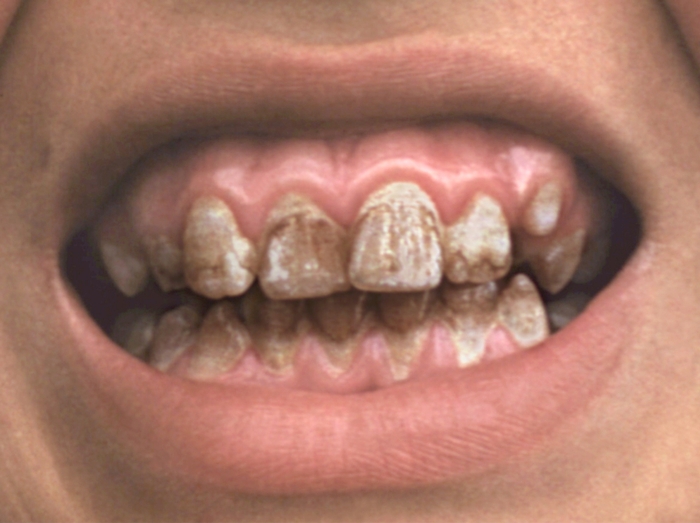 Зубы. Рис. 6