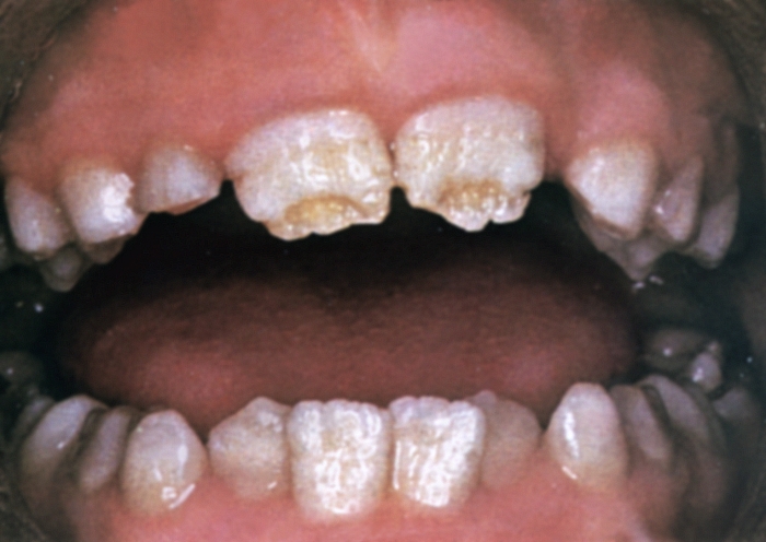 Зубы. Рис. 9
