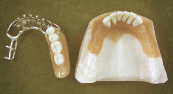 Протезирование зубов. Рис. 11