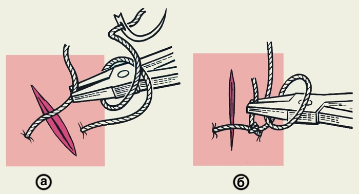 Швы хирургические. Рис. 8