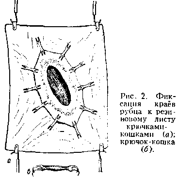 руминотомия. Рис. 2