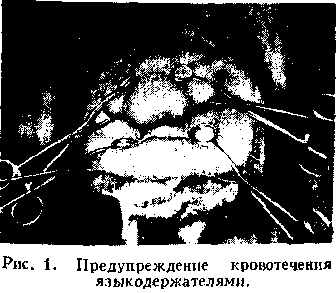 ринопластика